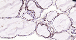 Cathepsin D Antibody in Immunohistochemistry (Paraffin) (IHC (P))