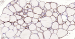 Cathepsin D Antibody in Immunohistochemistry (Paraffin) (IHC (P))