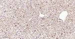 Cathepsin D Antibody in Immunohistochemistry (Paraffin) (IHC (P))