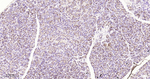 Cathepsin D Antibody in Immunohistochemistry (Paraffin) (IHC (P))