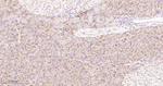 Cathepsin D Antibody in Immunohistochemistry (Paraffin) (IHC (P))