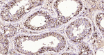 Cathepsin D Antibody in Immunohistochemistry (Paraffin) (IHC (P))