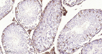 Cathepsin D Antibody in Immunohistochemistry (Paraffin) (IHC (P))