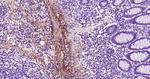 Tenascin C Antibody in Immunohistochemistry (Paraffin) (IHC (P))