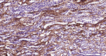 Tenascin C Antibody in Immunohistochemistry (Paraffin) (IHC (P))