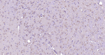 ASK1 Antibody in Immunohistochemistry (Paraffin) (IHC (P))