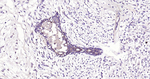 ASK1 Antibody in Immunohistochemistry (Paraffin) (IHC (P))