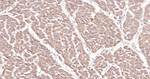 ASK1 Antibody in Immunohistochemistry (Paraffin) (IHC (P))