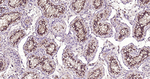ASK1 Antibody in Immunohistochemistry (Paraffin) (IHC (P))