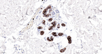 S100A8 Antibody in Immunohistochemistry (Paraffin) (IHC (P))