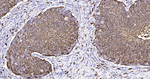 S100A8 Antibody in Immunohistochemistry (Paraffin) (IHC (P))