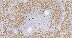 S100A8 Antibody in Immunohistochemistry (Paraffin) (IHC (P))