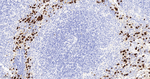 S100A8 Antibody in Immunohistochemistry (Paraffin) (IHC (P))