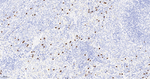 S100A8 Antibody in Immunohistochemistry (Paraffin) (IHC (P))