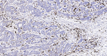 S100A8 Antibody in Immunohistochemistry (Paraffin) (IHC (P))