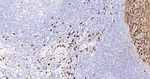 S100A8 Antibody in Immunohistochemistry (Paraffin) (IHC (P))
