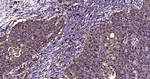 S100A8 Antibody in Immunohistochemistry (Paraffin) (IHC (P))