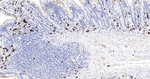 S100A8 Antibody in Immunohistochemistry (Paraffin) (IHC (P))