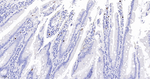 S100A8 Antibody in Immunohistochemistry (Paraffin) (IHC (P))