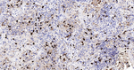 S100A8 Antibody in Immunohistochemistry (Paraffin) (IHC (P))