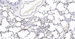 S100A8 Antibody in Immunohistochemistry (Paraffin) (IHC (P))