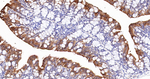 ABH1 Antibody in Immunohistochemistry (Paraffin) (IHC (P))