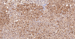 ABH1 Antibody in Immunohistochemistry (Paraffin) (IHC (P))