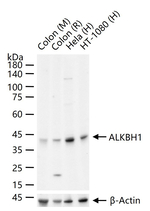 ABH1 Antibody in Western Blot (WB)