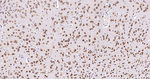 Annexin VII Antibody in Immunohistochemistry (Paraffin) (IHC (P))