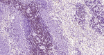 LEF1 Antibody in Immunohistochemistry (Paraffin) (IHC (P))