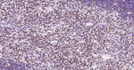 LEF1 Antibody in Immunohistochemistry (Paraffin) (IHC (P))