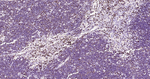 LEF1 Antibody in Immunohistochemistry (Paraffin) (IHC (P))