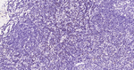 LEF1 Antibody in Immunohistochemistry (Paraffin) (IHC (P))