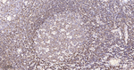 SHP-1 Antibody in Immunohistochemistry (Paraffin) (IHC (P))