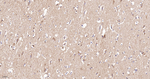 Annexin VII Antibody in Immunohistochemistry (Paraffin) (IHC (P))