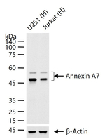 Annexin VII Antibody in Western Blot (WB)