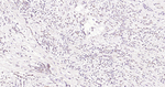 BAK Antibody in Immunohistochemistry (Paraffin) (IHC (P))