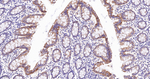 BAK Antibody in Immunohistochemistry (Paraffin) (IHC (P))