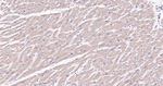 BAK Antibody in Immunohistochemistry (Paraffin) (IHC (P))