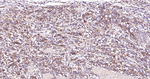 BAK Antibody in Immunohistochemistry (Paraffin) (IHC (P))