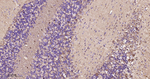 DARPP-32 Recombinant Rabbit Monoclonal Antibody (3G6)