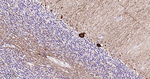 DARPP-32 Antibody in Immunohistochemistry (Paraffin) (IHC (P))