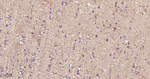 DARPP-32 Antibody in Immunohistochemistry (Paraffin) (IHC (P))