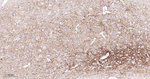 SSTR2 Antibody in Immunohistochemistry (Paraffin) (IHC (P))
