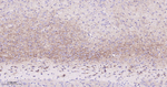 SSTR2 Antibody in Immunohistochemistry (Paraffin) (IHC (P))