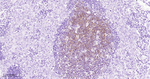 SSTR2 Antibody in Immunohistochemistry (Paraffin) (IHC (P))