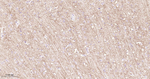 SSTR2 Antibody in Immunohistochemistry (Paraffin) (IHC (P))