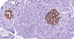 SSTR2 Antibody in Immunohistochemistry (Paraffin) (IHC (P))