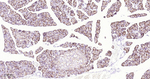 SSTR2 Recombinant Rabbit Monoclonal Antibody (8H1)