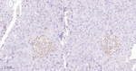 SSTR2 Antibody in Immunohistochemistry (Paraffin) (IHC (P))